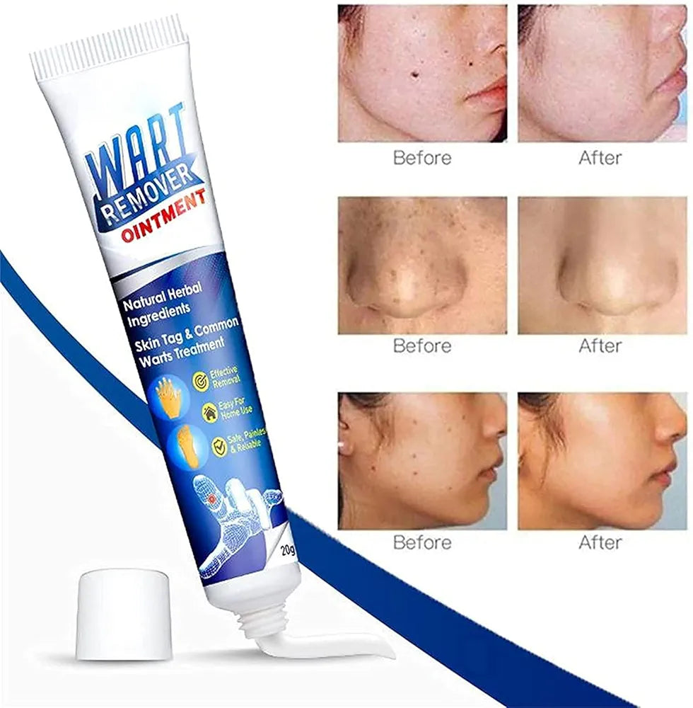 ✨ Wart &amp; Skin Tag Remover – كريم لإزالة الزوائد الجلدية والثآليل