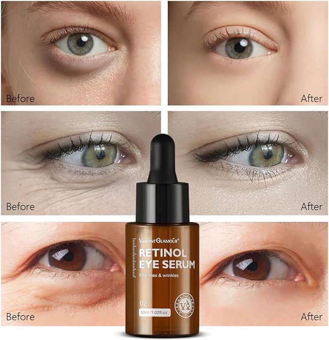 ✨ GLAMOUR Retinol Combo – كريم وسيروم مضاد للتجاعيد