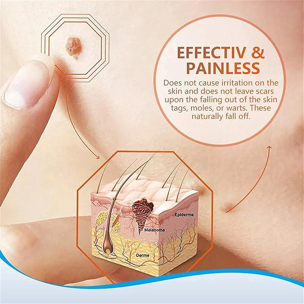 ✨ Wart &amp; Skin Tag Remover – كريم لإزالة الزوائد الجلدية والثآليل