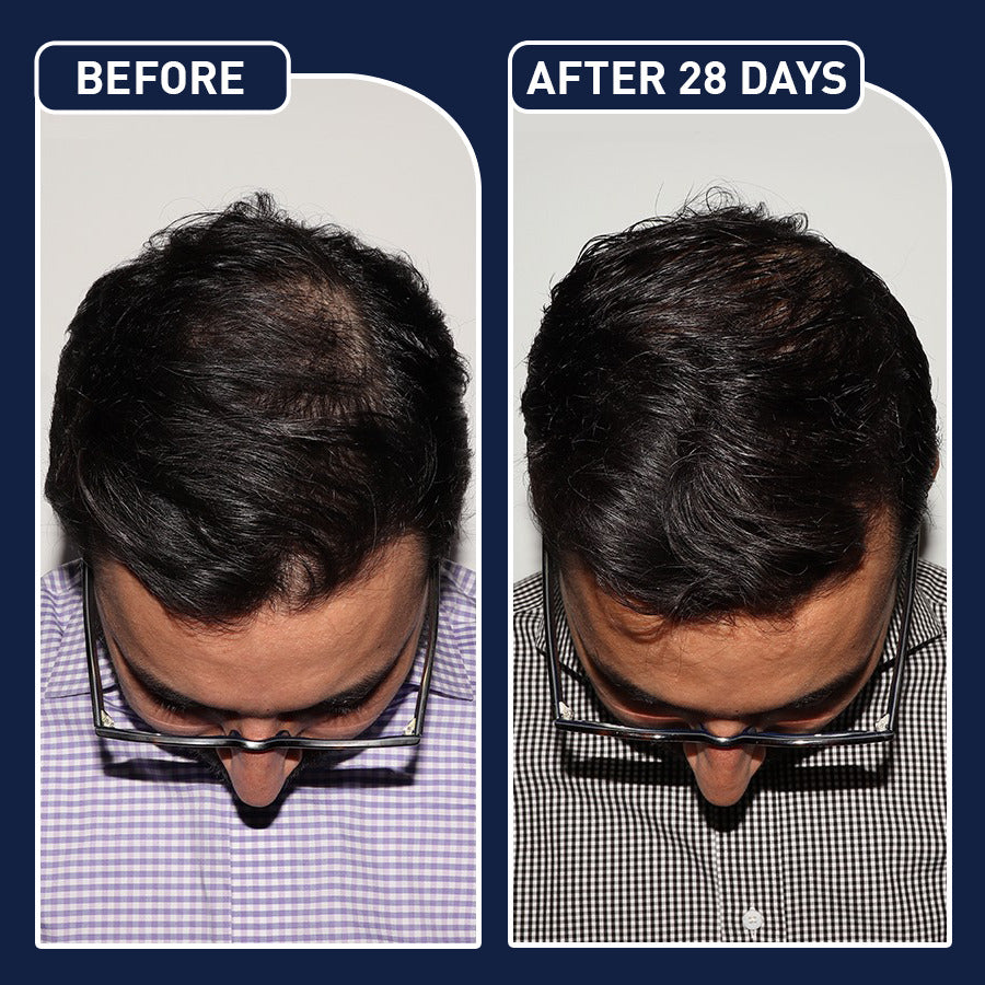 💇♀️ FEG Hair Spray سبراي الشعر FEG